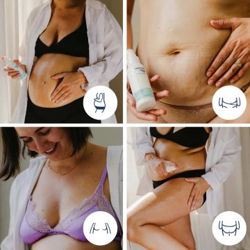 Doomoo & Shinncare Óleo Anti Estrias - 100 ml.